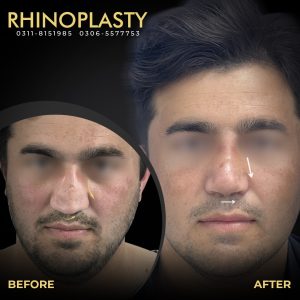 WhatsApp Image 2025-06-02 at 17.10.46